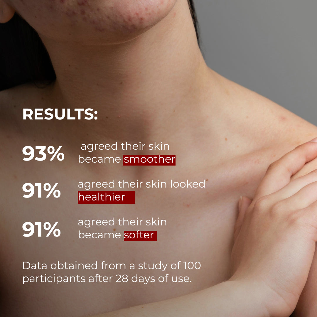 Zestaw Anti-Acne z kwasem salicylowym i peelingiem Róża & Babassu