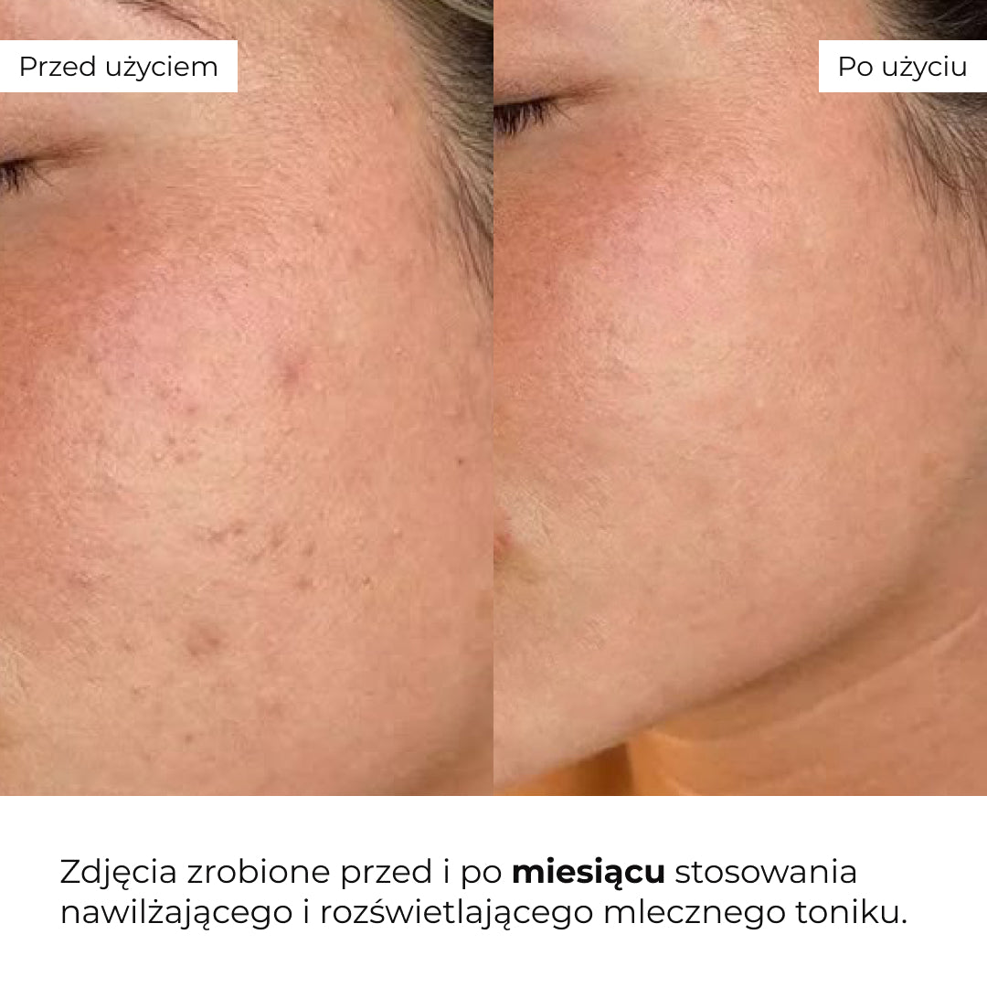 Tonik-mleczko do nawilżania i rozświetlania skóry Hillary Milky Glow Toner, 100 ml