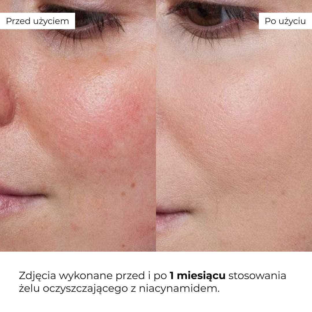 Oczyszczający żel do mycia twarzy z niacynamidem Hillary Niacinamide Balance Cleansing Gel, 100 ml