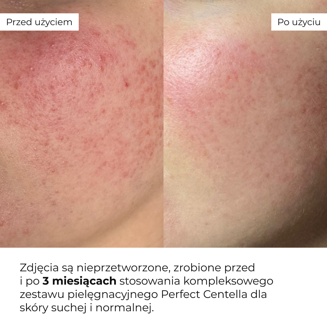 Zestaw do pielęgnacji skóry suchej i normalnej Hillary Perfect Centella Deep Hydration