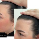 Szampon przeciw wypadaniu włosów Hillary Serenoa & PP Hair Loss Control Szampoo, 250 ml